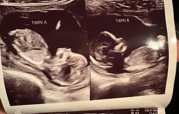 deux bébés @instagram
